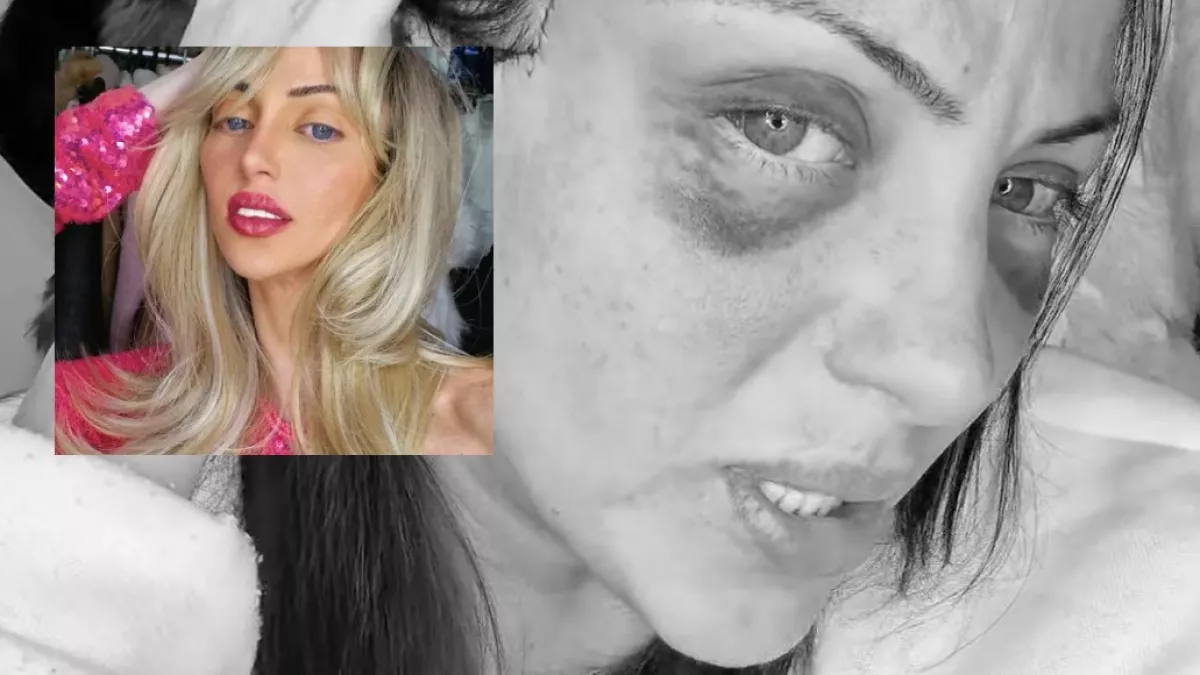 Holtan találtak egy 31 éves influenszert: Barbara 27 plasztikai műtétjével lett netes celeb - Fotók