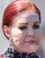 Dallas, Priscilla Presley, plasztika, botox, 