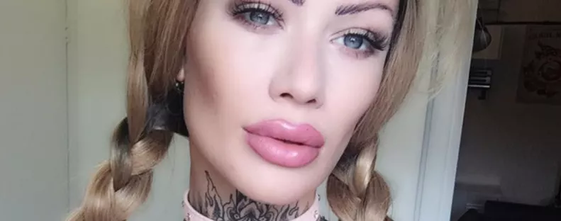 Gyönyörű nő volt, az agyonoperált teste 95%-át ma már tetkók borítják – Fotók