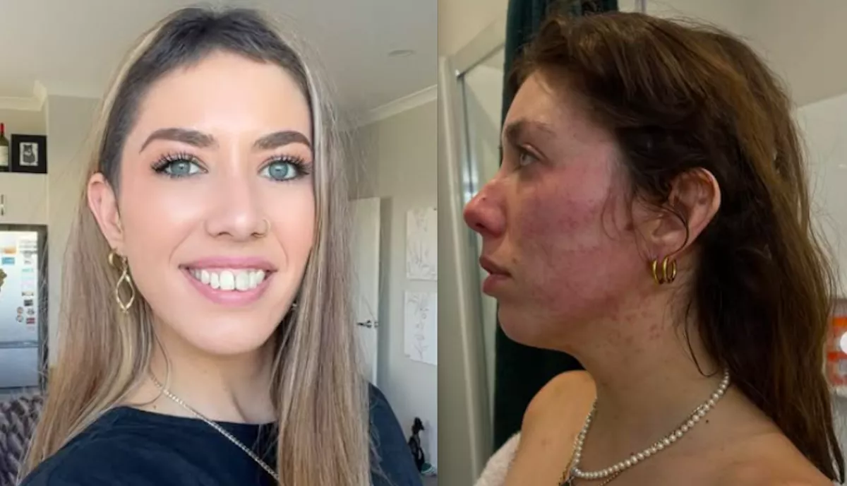 Letaglózta a fiatal lányt a rákdiagnózis: egy év múlva hihetetlen dolgot fedeztek fel az orvosok - Videó