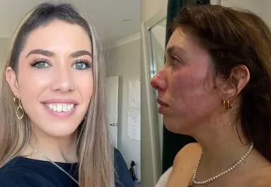 Letaglózta a fiatal lányt a rákdiagnózis: egy év múlva hihetetlen dolgot fedeztek fel az orvosok - Videó