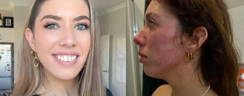 Letaglózta a fiatal lányt a rákdiagnózis: egy év múlva hihetetlen dolgot fedeztek fel az orvosok - Videó