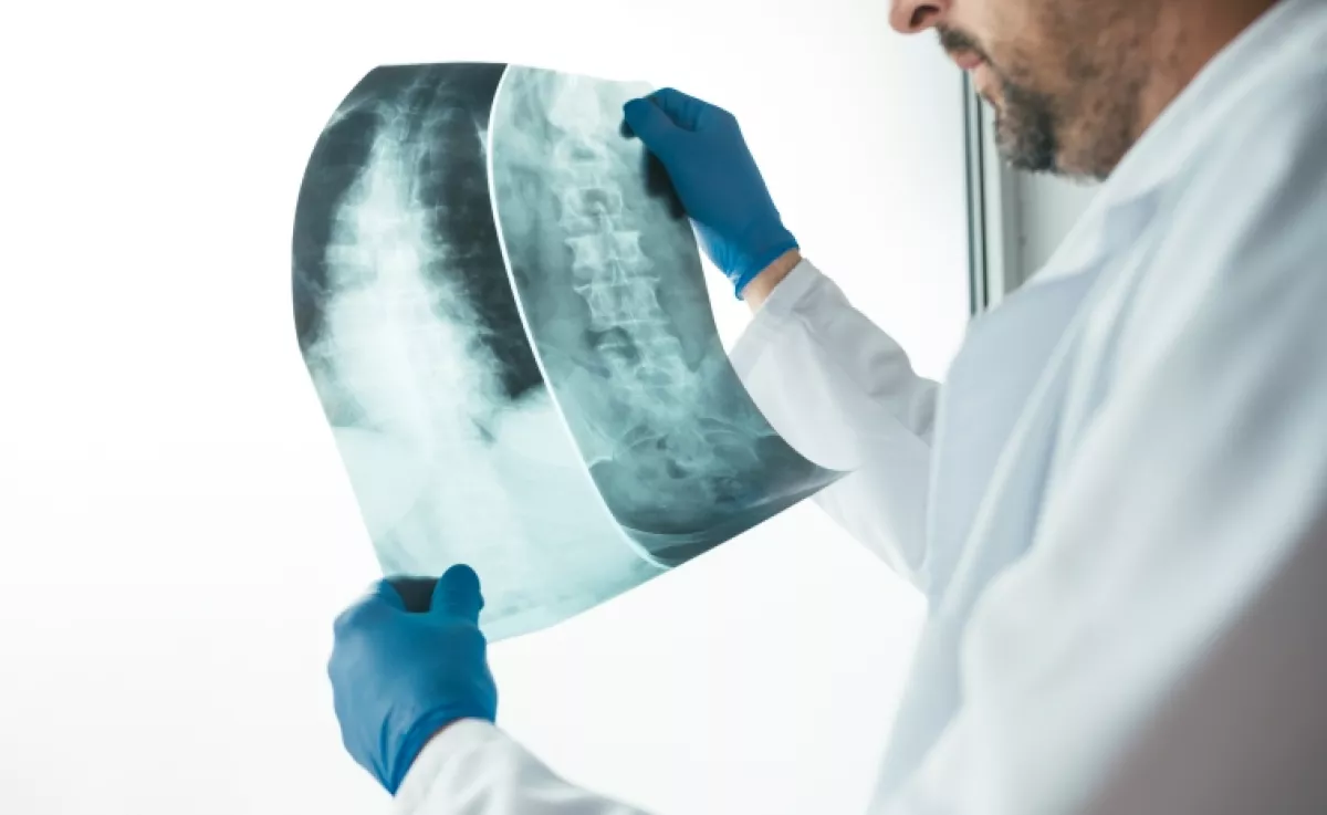 Titokban tönkreteszi a csontokat a magyarok kedvenc itala: naponta fogyasztjuk, pedig káros hatása is van bőven