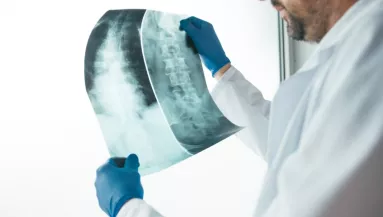 Titokban tönkreteszi a csontokat a magyarok kedvenc itala: naponta fogyasztjuk, pedig káros hatása is van bőven