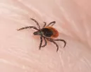 Nem csak Lyme-kórt okozhat a kullancscsípés: évekkel később ez a furcsa baj is jelentkezhet miatta