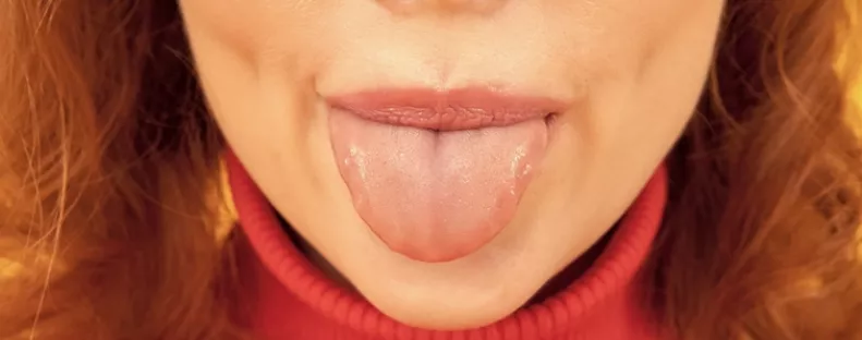 Nem játék: ha ilyen színű a nyelved reggel, azonnal menj orvoshoz