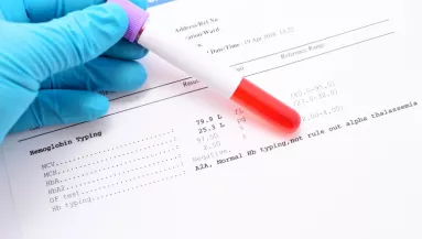 Nem a koleszterin az: ez az érték árulkodik valójában a laborleleten a szív állapotáról