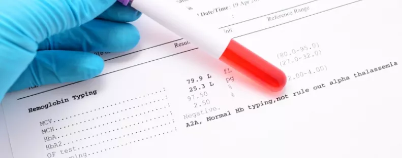 Nem a koleszterin az: ez az érték árulkodik valójában a laborleleten a szív állapotáról