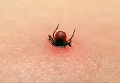 Kullancsszezon 2025: 5 tipp, amit mindenkinek ismernie kell 