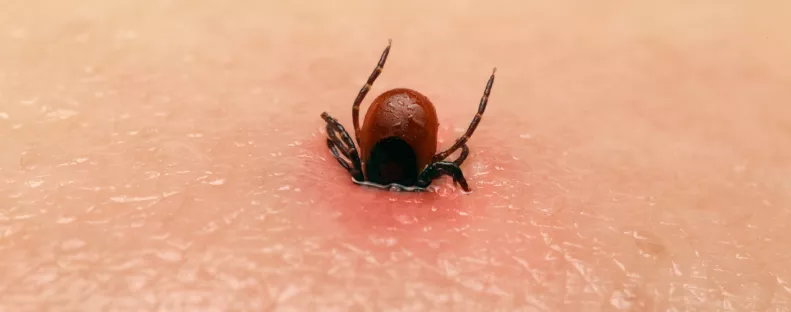 Kullancsszezon 2025: 5 tipp, amit mindenkinek ismernie kell 