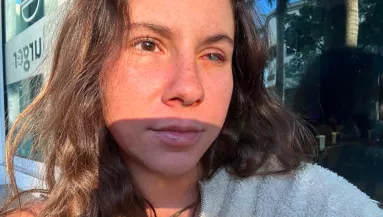 Paradicsomi nyaralásból rémálom: parazita falta fel Vivi szemét