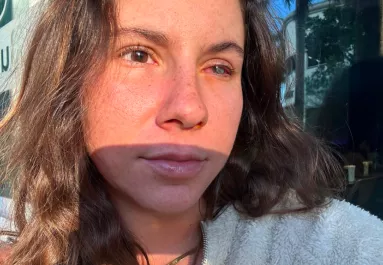 Paradicsomi nyaralásból rémálom: parazita falta fel Vivi szemét