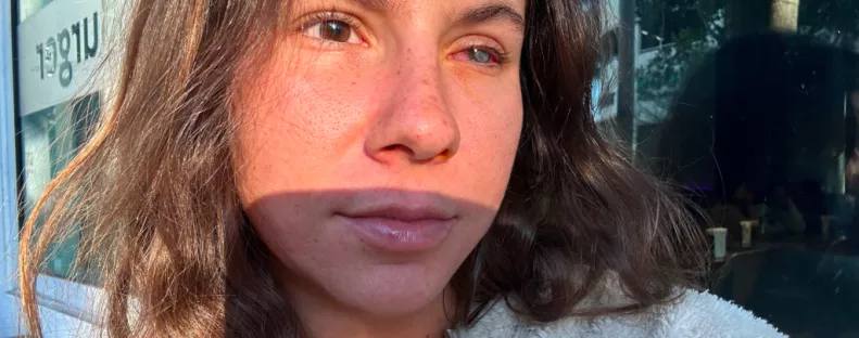 Paradicsomi nyaralásból rémálom: parazita falta fel Vivi szemét