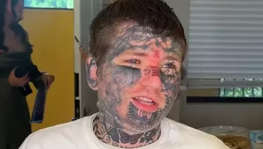 El akarta tüntetni az arctetkóit az esküvőre: amit tett, lenyűgöző