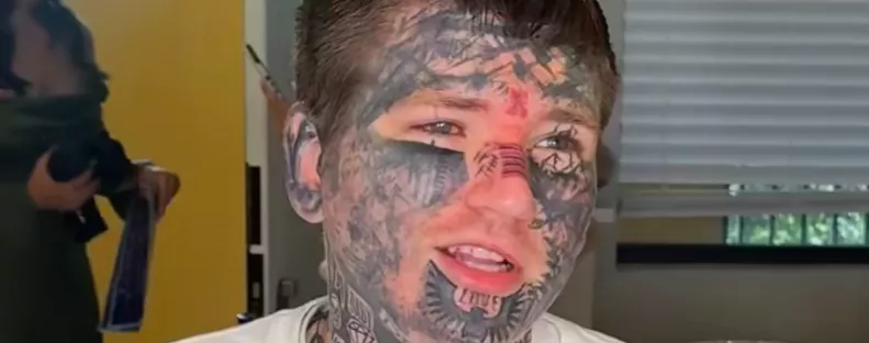 El akarta tüntetni az arctetkóit az esküvőre: amit tett, lenyűgöző