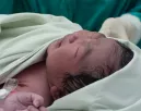 Levágta a baba ujját egy szülésznő a császármetszés során - A kórház hallgat