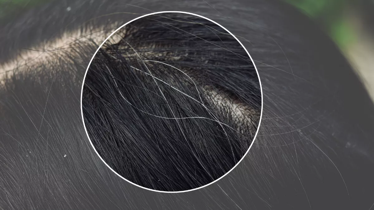 Kevesen tudják: ezért veszélyes kitépni az ősz hajszálakat