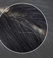 Kevesen tudják: ezért veszélyes kitépni az ősz hajszálakat