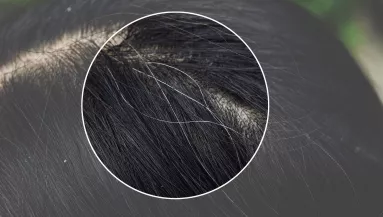 Kevesen tudják: ezért veszélyes kitépni az ősz hajszálakat