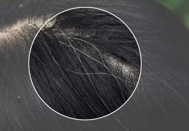 Kevesen tudják: ezért veszélyes kitépni az ősz hajszálakat