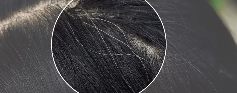 Kevesen tudják: ezért veszélyes kitépni az ősz hajszálakat