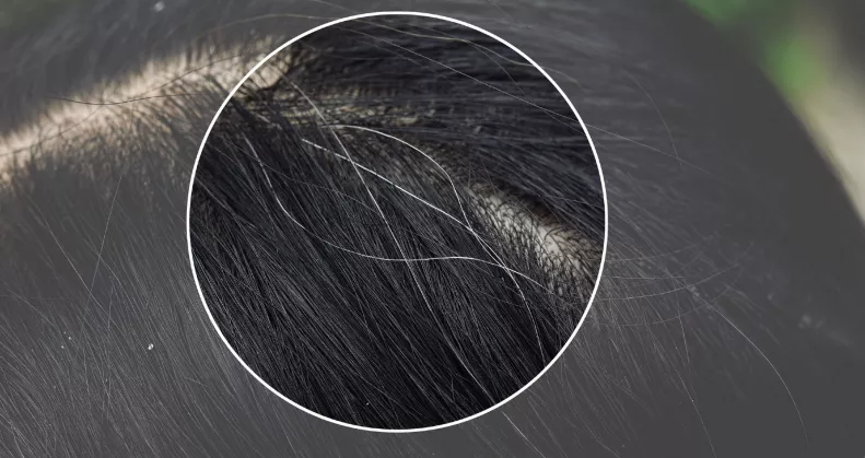 Kevesen tudják: ezért veszélyes kitépni az ősz hajszálakat