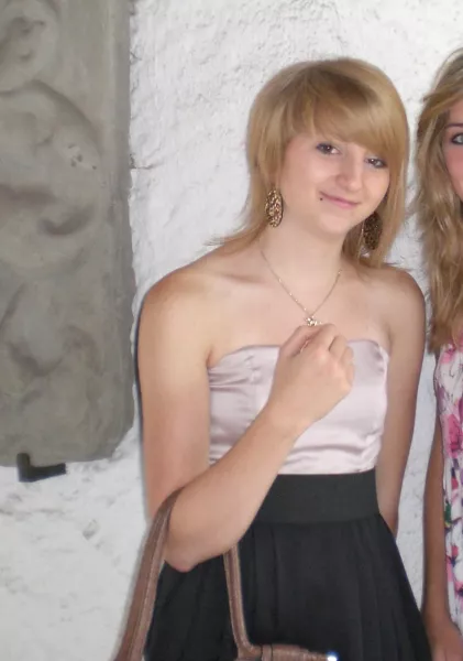 Celine Centino, plasztika, átalakulás, 