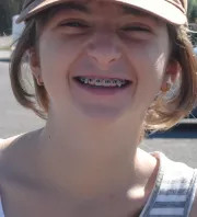 Tízmilliókat költött plasztikára ez a lány – Megőrülnek érte a férfiak