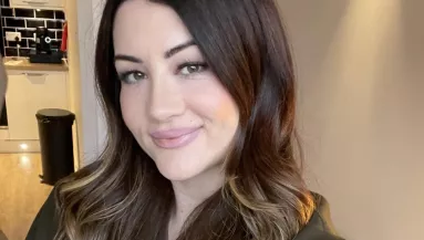 Rémálommá vált a 170 ezres botox – "Sikoly-arca" lett a nőnek