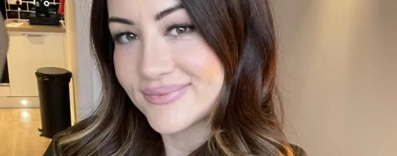 Rémálommá vált a 170 ezres botox – "Sikoly-arca" lett a nőnek