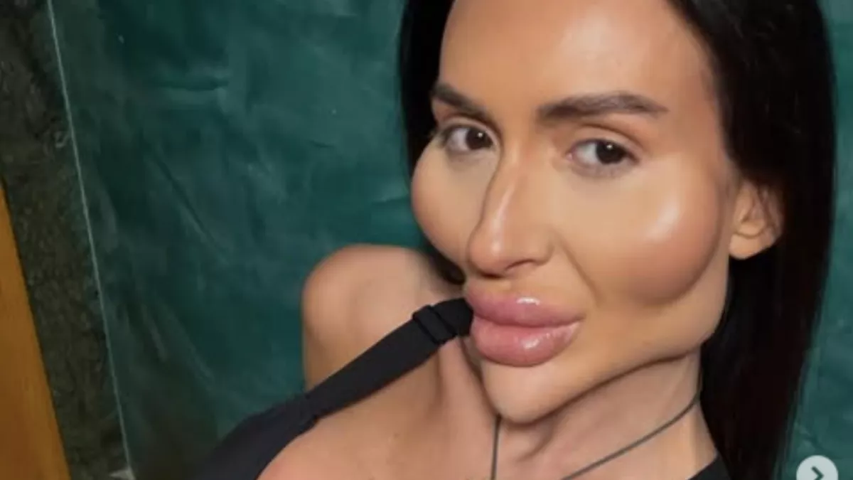 XXL-arccsontokat plasztikázott magának: most a régi fotóival sokkolja most a rajongóit