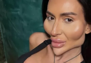 XXL-arccsontokat plasztikázott magának: most a régi fotóival sokkolja most a rajongóit