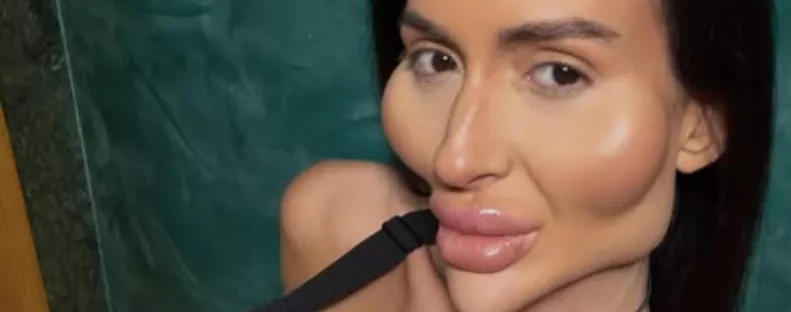 XXL-arccsontokat plasztikázott magának: most a régi fotóival sokkolja most a rajongóit