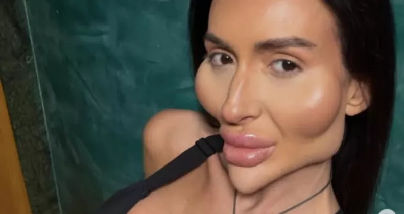 XXL-arccsontokat plasztikázott magának: most a régi fotóival sokkolja most a rajongóit