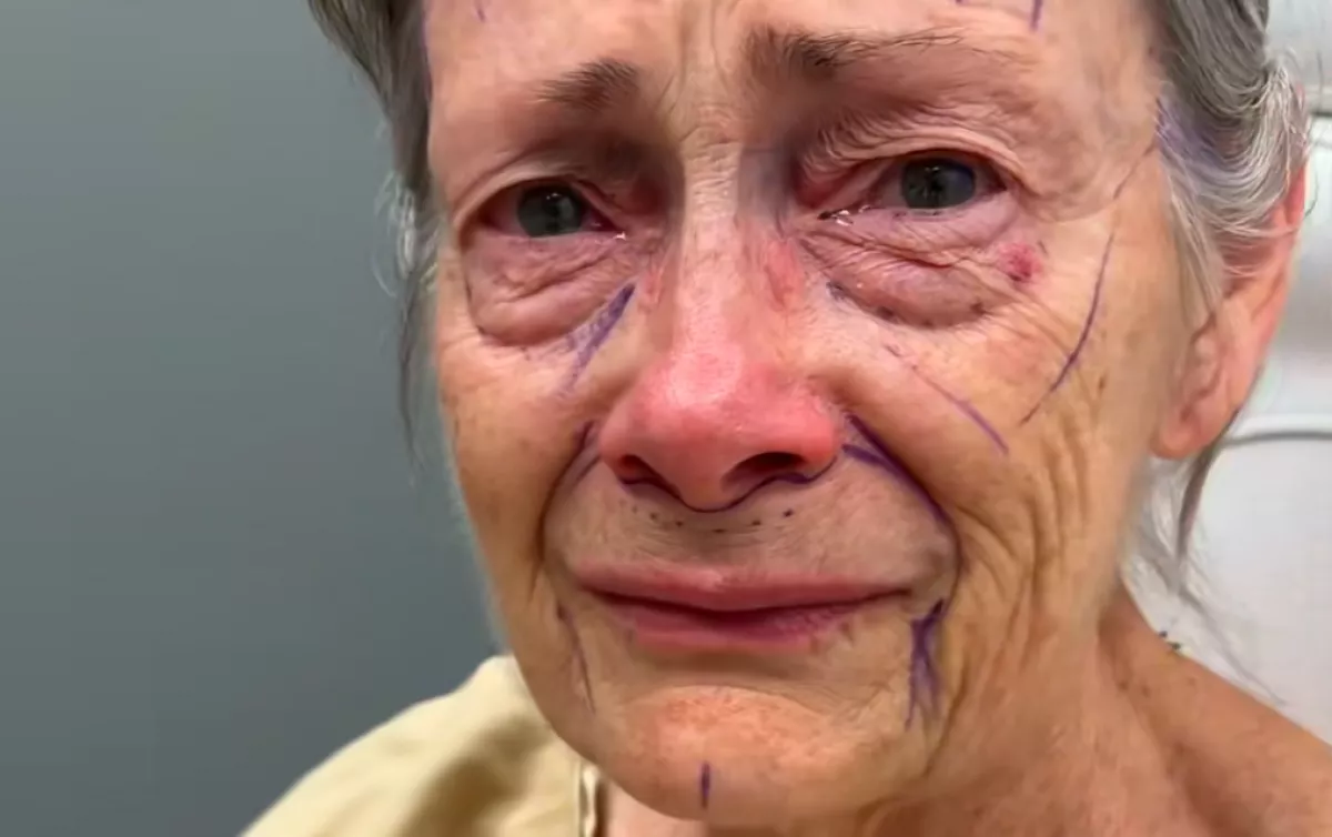 Csodaként terjed a plasztikai beavatkozás: évtizedekkel lett fiatalabb a nagyi