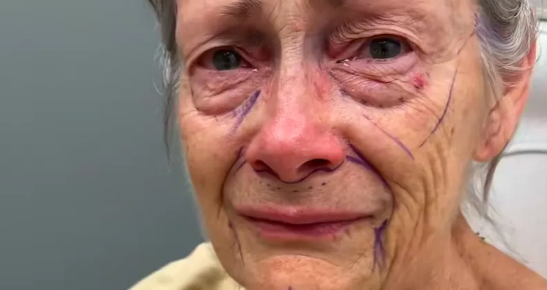 Csodaként terjed a plasztikai beavatkozás: évtizedekkel lett fiatalabb a nagyi