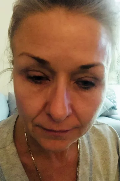 smink, theresa lynch, orvos, baki, 