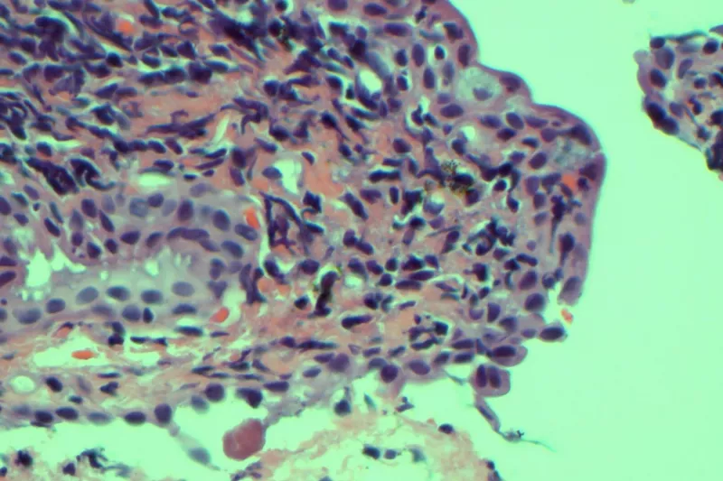 smink, theresa lynch, orvos, baki, 