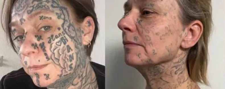 A tulajdonának hitte: 250-szer tetoválta a nevét a barátnőjére egy férfi