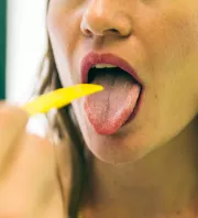 Fehér lepedék a nyelven: mi okozhatja és hogyan lehet kezelni?