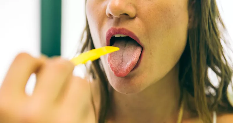 Fehér lepedék a nyelven: mi okozhatja és hogyan lehet kezelni?