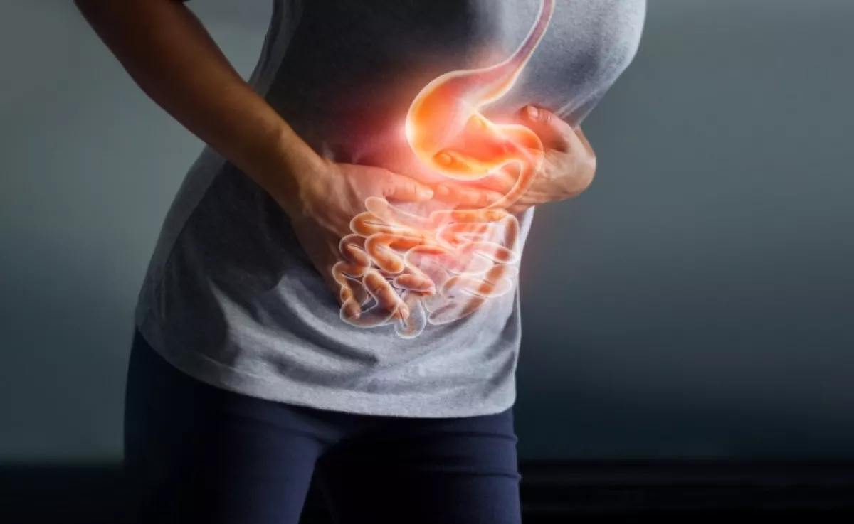 Nem a mozgáshiány az első számú rizikó: ez növeli leginkább a bélrák kialakulásának kockázatát