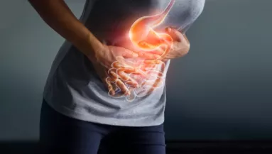 Nem a mozgáshiány az első számú rizikó: ez növeli leginkább a bélrák kialakulásának kockázatát