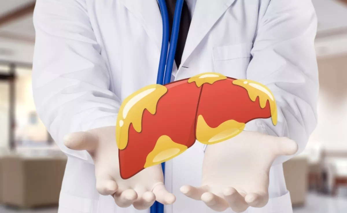 Lehet, hogy téged is érint: ettől a kombinációtól alakul ki leggyakrabban a zsírmáj