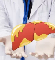 Lehet, hogy téged is érint: ettől a kombinációtól alakul ki leggyakrabban a zsírmáj