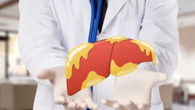 Lehet, hogy téged is érint: ettől a kombinációtól alakul ki leggyakrabban a zsírmáj