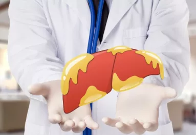 Lehet, hogy téged is érint: ettől a kombinációtól alakul ki leggyakrabban a zsírmáj