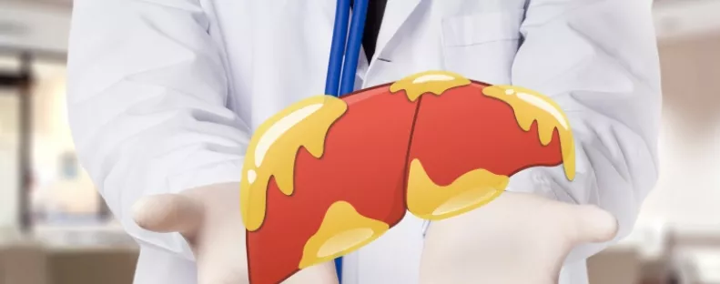 Lehet, hogy téged is érint: ettől a kombinációtól alakul ki leggyakrabban a zsírmáj