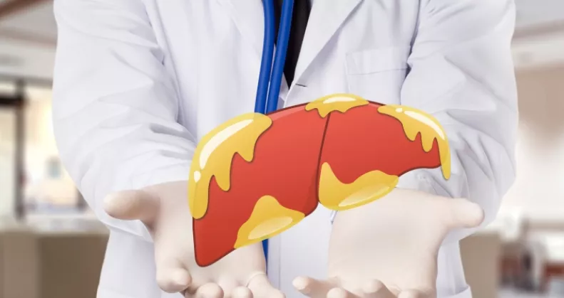 Lehet, hogy téged is érint: ettől a kombinációtól alakul ki leggyakrabban a zsírmáj